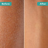 Dry Brush With Cellulite Massager - Before and After